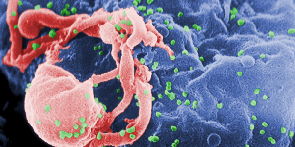 HIV image